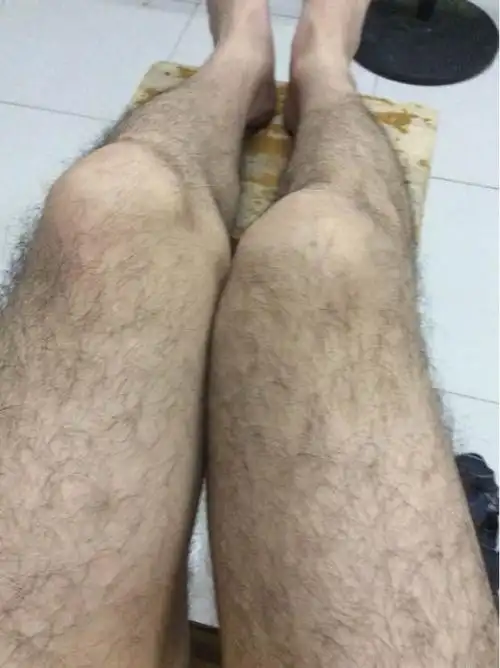 哪种脱毛方法好呢?75脱腿毛用激光!