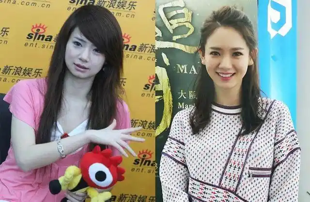 比如戚薇,之前的方腮就比较明显的,现在的脸型,有个精巧的下巴,脸型一