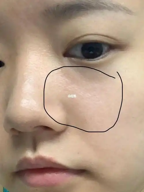 家人们,这个毛孔正常吗_毛孔_护肤_凡尔赛_隐形毛孔_办公室_防晒_美妆