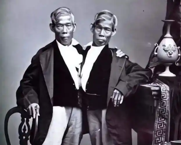 连体人算一个人还是两个人?暹罗连体兄弟娶姐妹花,共生22个孩子