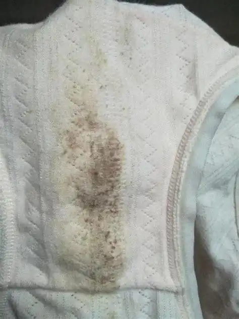 长了阴虱虫内裤的图片有阴虱的内裤是怎样的2022已更新今日资讯