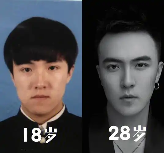 "地包天"的逆袭(颌面篇)