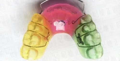 下颌联冠斜面导板图片