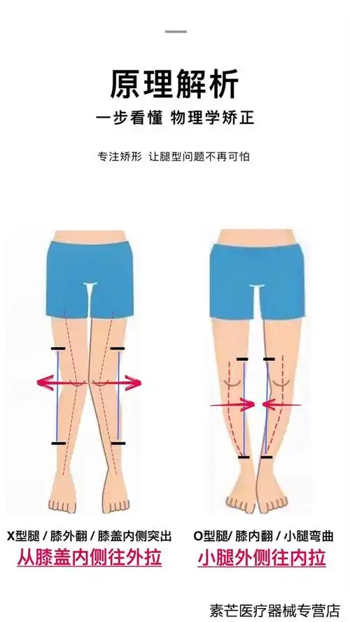 京健康儿童xo型腿矫正器纠正膝内外翻小腿外翻绑腿带罗圈腿支具o型腿