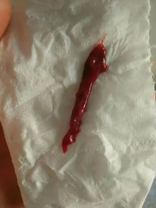 每一次大姨妈来的时候.卫生巾上面就会出现这个东西1-2次 &