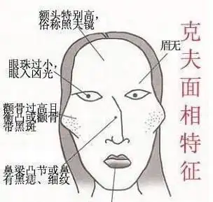 刻薄的人长什么样?刻薄女人面相