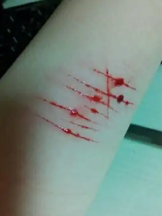 根据图片看伤口不深,结疤恢复时不要用手抠伤疤的话应该