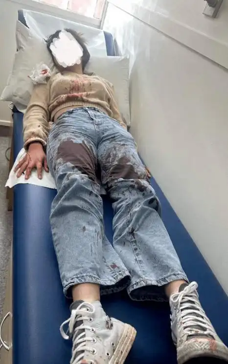 "浑身是血,差点毁容!"12岁亚裔女孩在奥克兰麦当劳被围殴!