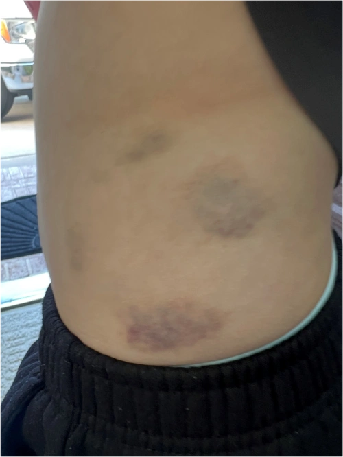 妈妈分享孩子在美国daycare被老师abuse我是这样做的