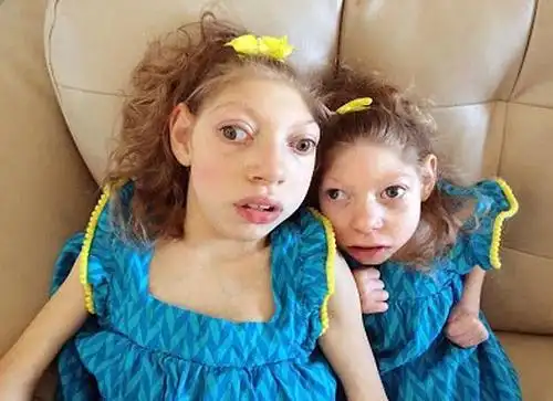 一对美国的小姐妹,平均身高不到80厘米却很幸福_格温