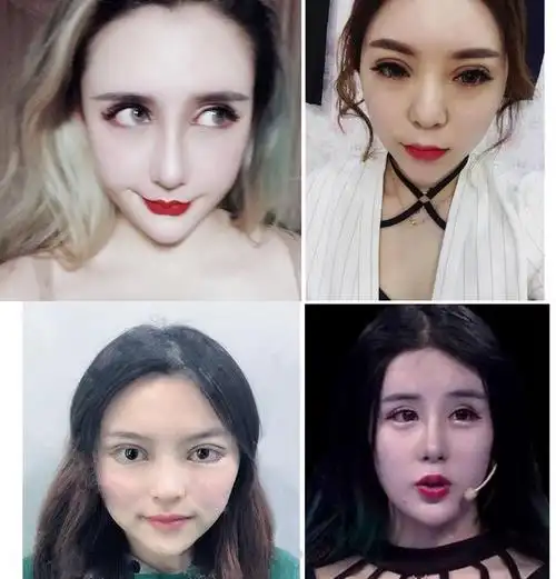 明星模版分析:为什么想整容成baby的最后都成了低配网红脸