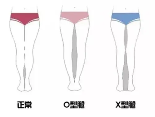 根据自己腿型选裤子,你一定穿错过!