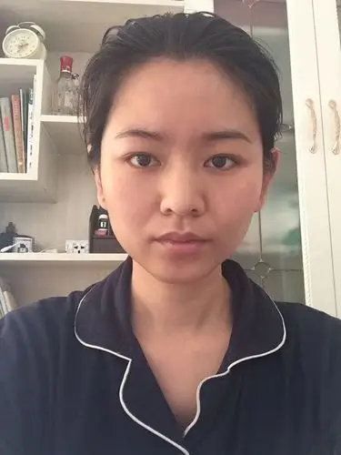 试着给你缩了人中,好像效果不太妙 原来是法令纹没解决掉