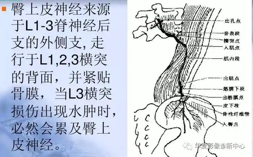 【影像基础】第三腰椎横突综合征,你忽略了吗?