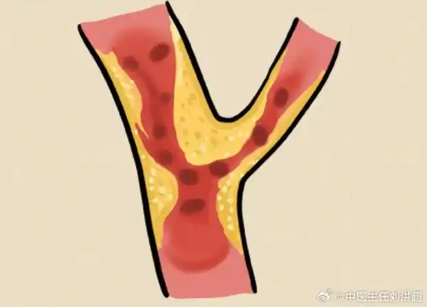 国医的精诚力量##中医式生活##中医科普