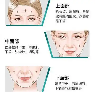 面部衰老卡通示意图