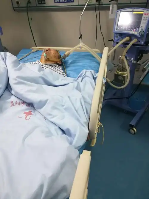 呼吸机,电除颤,死神面前不慌乱! ——icu的抢救日常