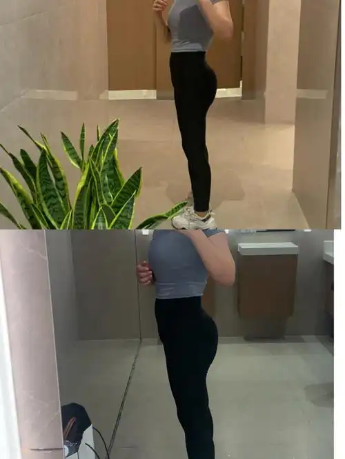 威塑腰腹吸脂人鱼线