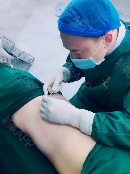 【长沙艾依美整形——腹部精雕】术后第一天耶~~  女人真的是 要么瘦