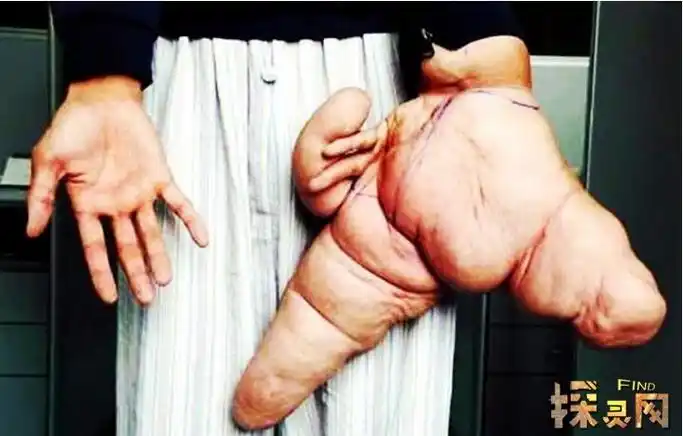 世界上恐怖怪异的畸形人看完做噩梦胆小勿入