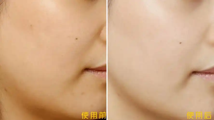 让我很惊喜的是,这次用了抗糖小白瓶之后,肤色均匀了不少,虽然比不了