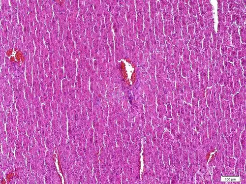 关于小鼠肝脏病理切片的请教