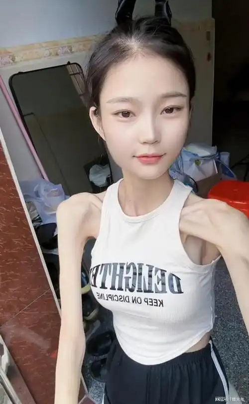广东一女子身高一米六,骨瘦如柴体重不到60斤,她却觉得自己很美