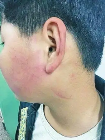 学生不小心撞开校长门 被其拳打脚踢狂扇耳光