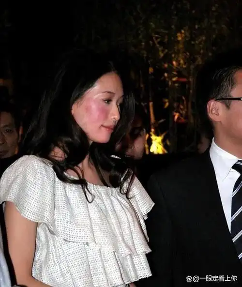 曾一意孤行嫁到日本的林志玲!如今鼻子被打坏,家暴更是家常便饭