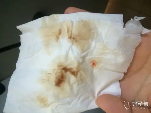 着床出血是这样子吗?就上厕所一点点