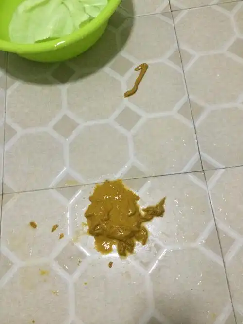 便秘什么的调理肠胃都用过没有效果