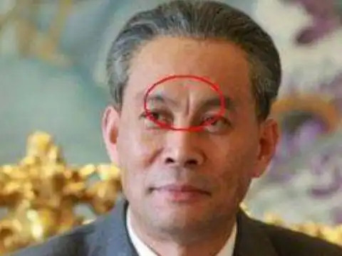 男人印堂凹陷,命运多变在面相学中,一般印堂都是属于聚焦福气的位置