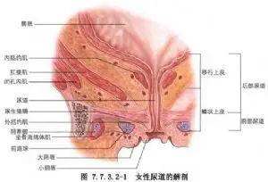 尿道肉阜环切除术