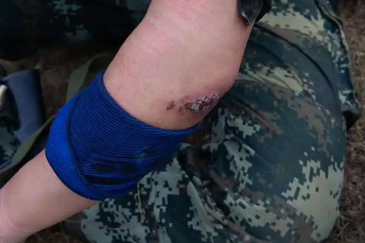 身为新时代革命军人,无论在执行任务中还是训练场上,身上被刮伤蹭破是