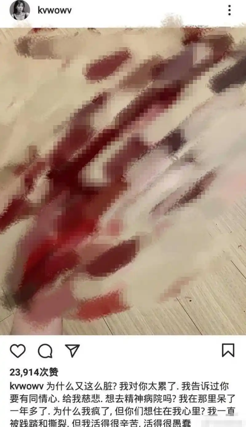 前女团成员权珉娥忧郁症发作,半夜晒自残照片,情绪崩溃吓坏网友