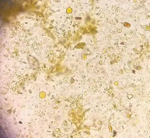 图1 湿片  x400近几年,通过科室内的滴裱凹巴鲜悠堤,对人芽