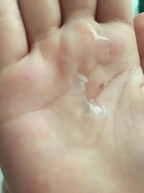 这是什么东西,最近尿尿的地方总有这个,还特别多,透