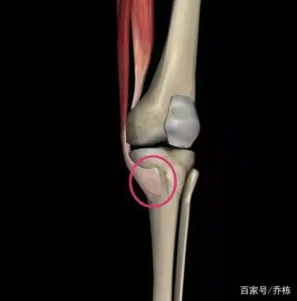 膝盖内侧疼,这是怎么回事呢?