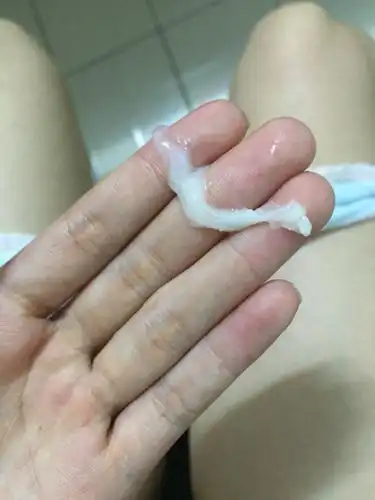 大姨妈过去好多天了,感觉黏黏,一摸,抽出这样一条巨型成型白带,什么鬼