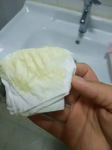 育儿问答 怀孕期 这到底怎么回事,今天去看,医生跟我说没事!