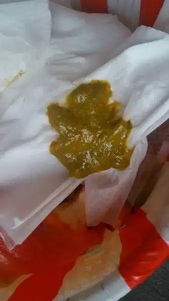 还吃母乳!拉这样的便便!没事吧?