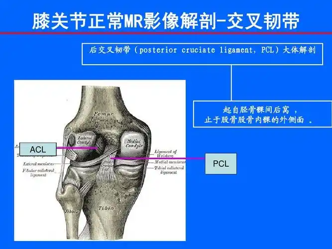 膝关节常见损伤性病变的mr表现ppt