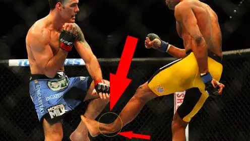 ufc蜘蛛人安德森·席尔瓦断腿之后模仿李小龙0:00:21简 介:魏德曼断腿