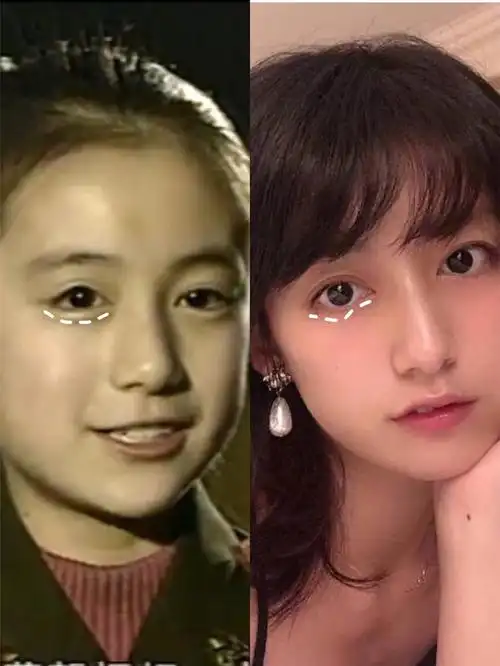 医美美商进阶||被众多女明星夸赞天然神颜的黑尾酱做_圈子-新氧美容