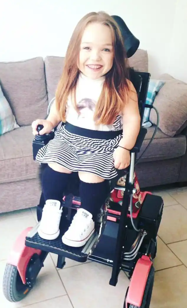 英国一女子患侏儒症,身高只有79cm,每天吃大量镇痛药来止痛