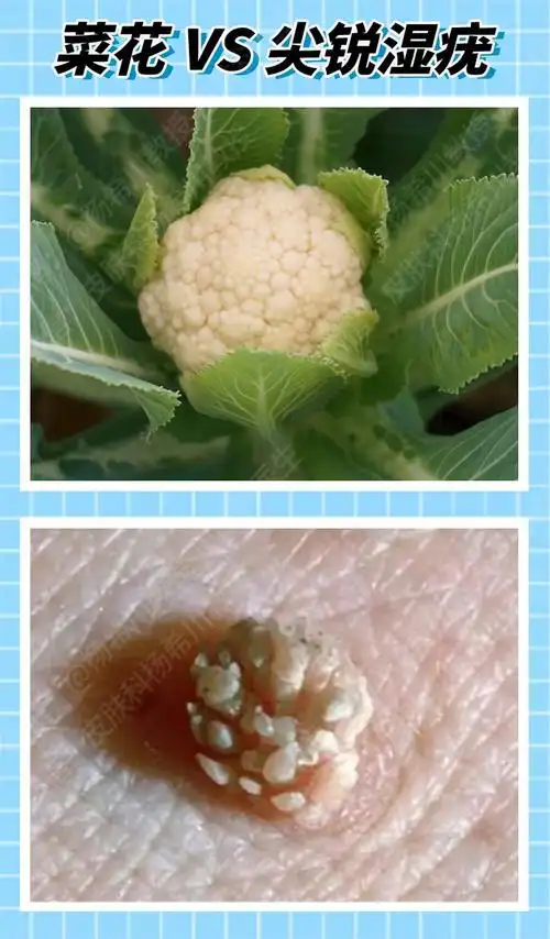 皮肤科医生的职业病,看啥食物都像皮肤病