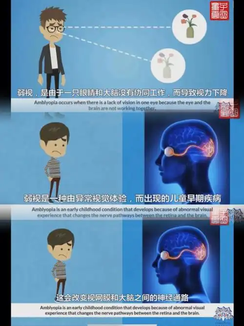 弱视到底是什么