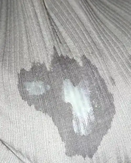 孕32周乳白色糊状分泌物正常吗?