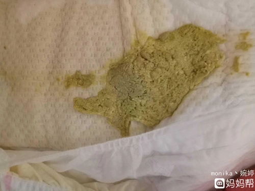 出生开始就一直排出灰白色或陶土色,含有较硬的粒状并伴有臭味的大便