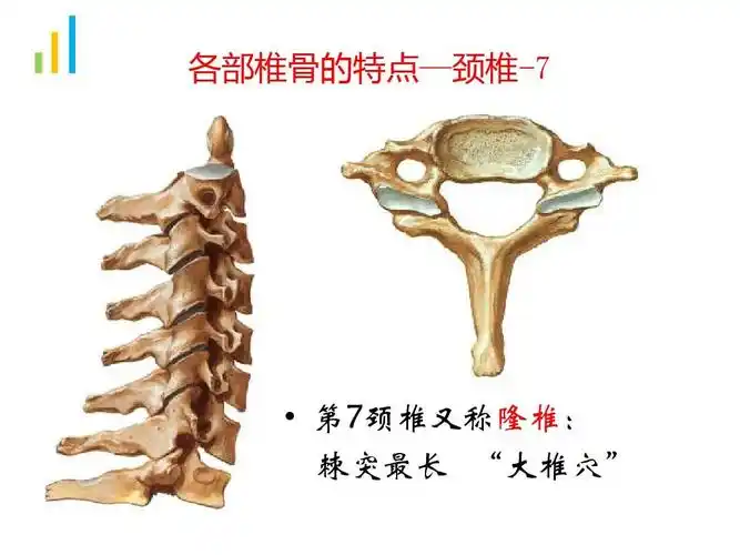颈椎骨折病人的护理-龚婕ppt